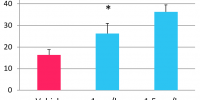 Anxiogenic areas in the elevated plus-maze test