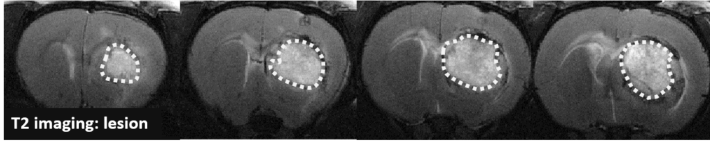 Rat T2 MRI lesion after collagenase