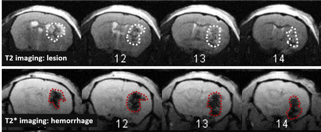 MRI T2 T2star- Mouse Lesion