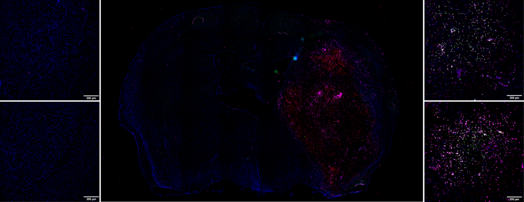 Example of immunohistochemistry marking in the ICH model